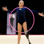 10-Year-Old Ukrainian Gymnast Wins Gold After Losing Leg In Russian Strike